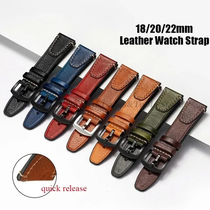 العالمي ريترو حزام الساعات ل ر - مراجعة Watches Rolex Smartwatch وسعره